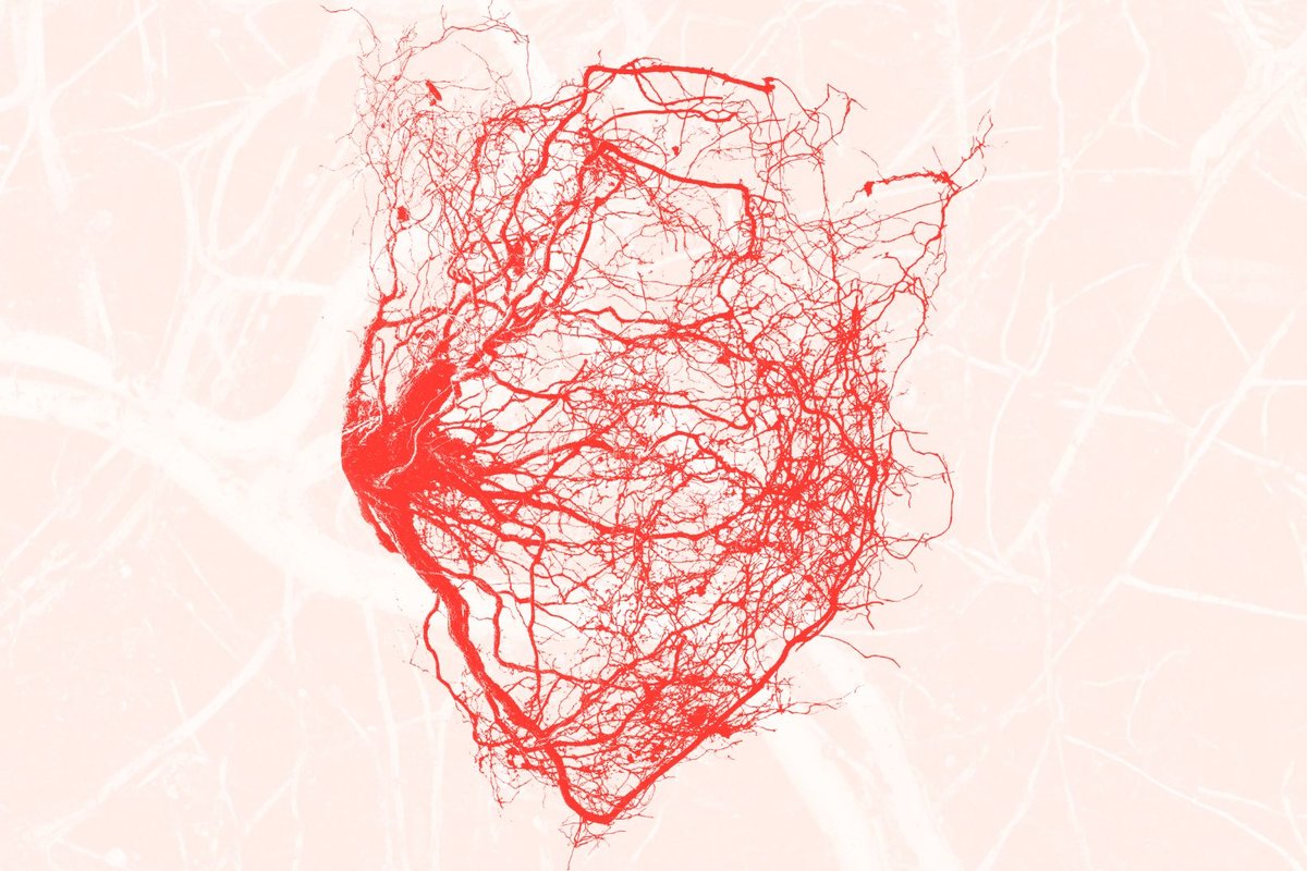 Untitled design